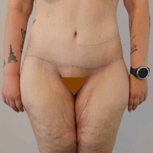 Efter billede